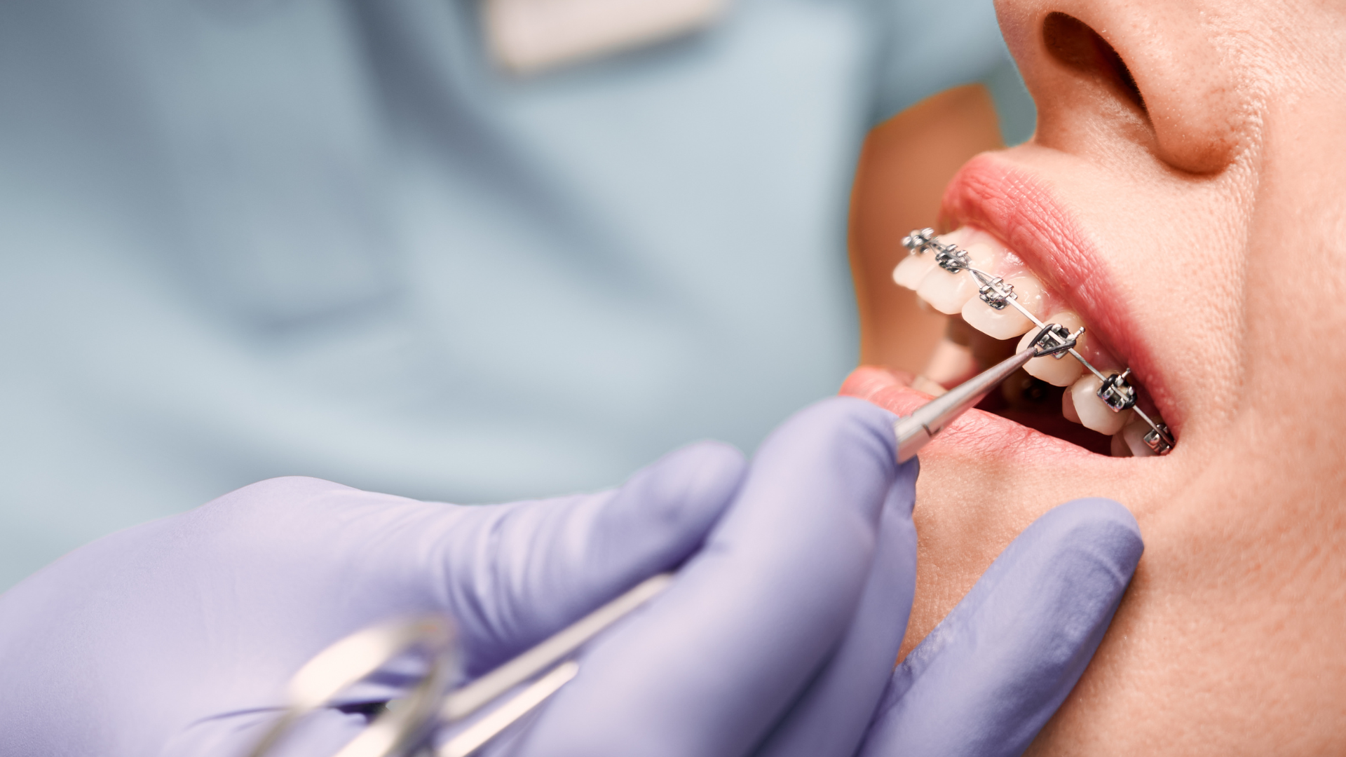 Why Should You See an Orthodontist Instead of a General Dentist?